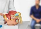 DÍA DEL CÁNCER DE PRÓSTATA: SE DIAGNOSTICAN MÁS DE 11.000 CASOS POR AÑO EN ARGENTINA