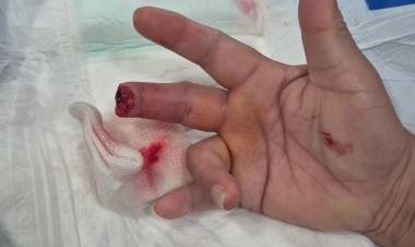 TRABAJADORA DE LA SALUD SUFRIÓ LESIONES GRAVÍSIMAS TRAS UNA AGRESIÓN