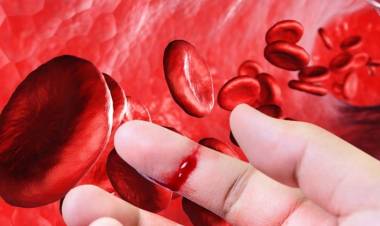 UN NUEVO TRATAMIENTO PARA LA HEMOFILIA ESTÁ DISPONIBLE EN ARGENTINA