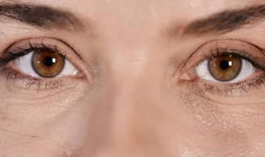 PÁRPADOS CAÍDOS Y BOLSAS: CÓMO FUNCIONA LA BLEFAROPLASTIA CON LÁSER HÍBRIDO