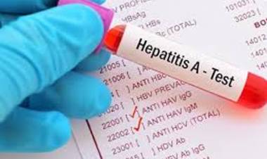 HEPATITIS A Y HEPATITIS E: SE REALIZÓ UNA VIGILANCIA AMBIENTAL EN AGUAS RESIDUALES