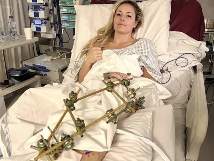 EL EMOTIVO MENSAJE DE CRISTIANO RONALDO A UNA ATLETA QUE SUFRIÓ UNA ESCALOFRIANTE LESIÓN